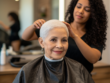 Woman with alopecia