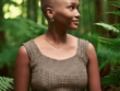 A woman with alopecia