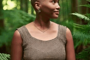 Alopecia