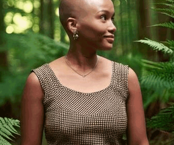 A woman with alopecia