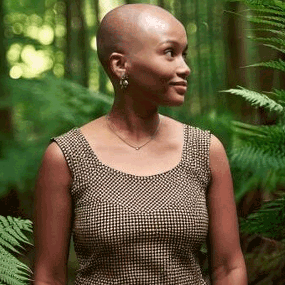 Alopecia and Its Different Types