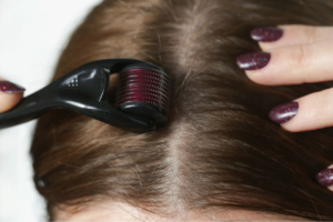 Derma Roller on scalp